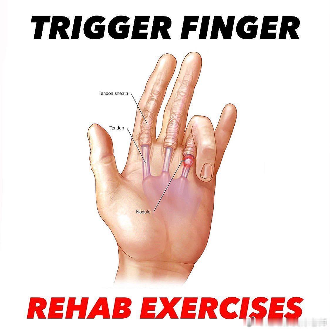 运动康复 来，正刷到这一条的你，先把头抬起来，然后做套手部放松训练，缓解手指的僵