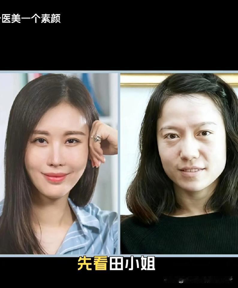 一个医美一个素颜•相由心生