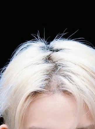 哥哥你头还好吗