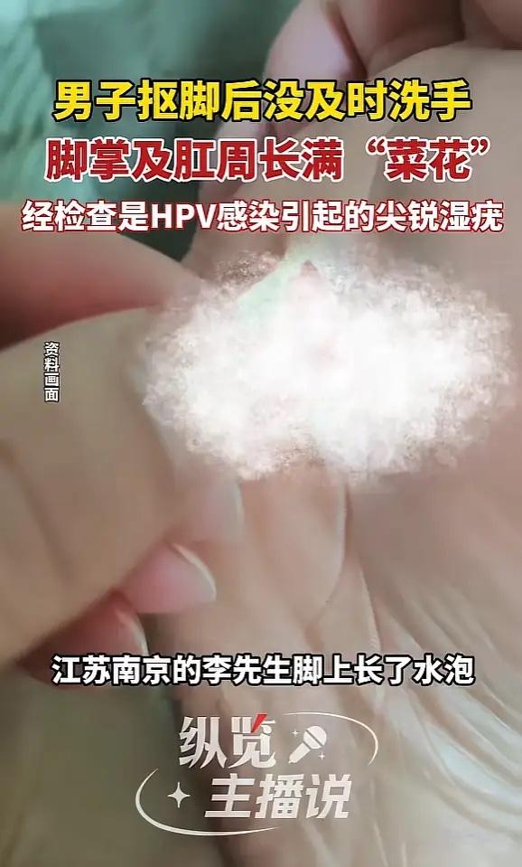 江苏南京，一男子脚上长了水泡，用手抠破后，伤口处竟然长出“菜花”！并且有蔓延的趋