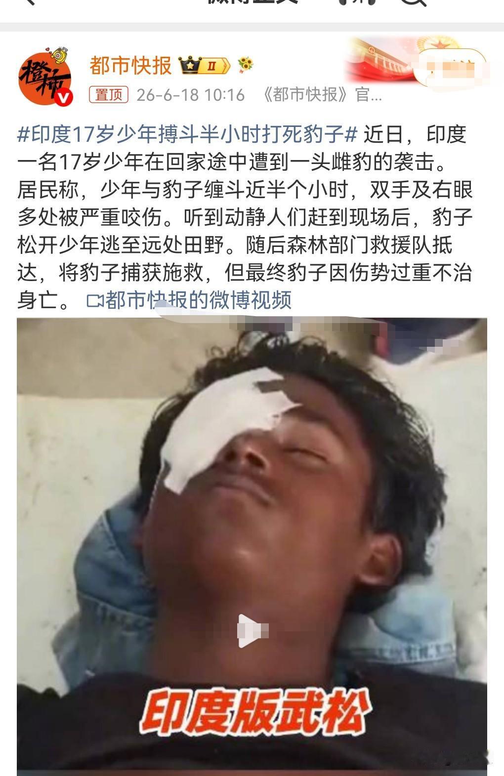 这真是印度版武松啊，近日，印度17岁少年搏斗半小时打死豹子。

由于森林覆盖率越
