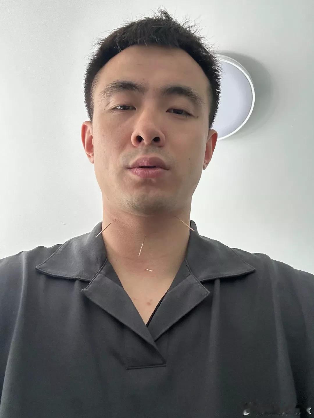 赵继伟工作室分享赵继伟治疗咽喉伤病的照片，恕我直言，赵继伟这嗓子应该很难恢复如初