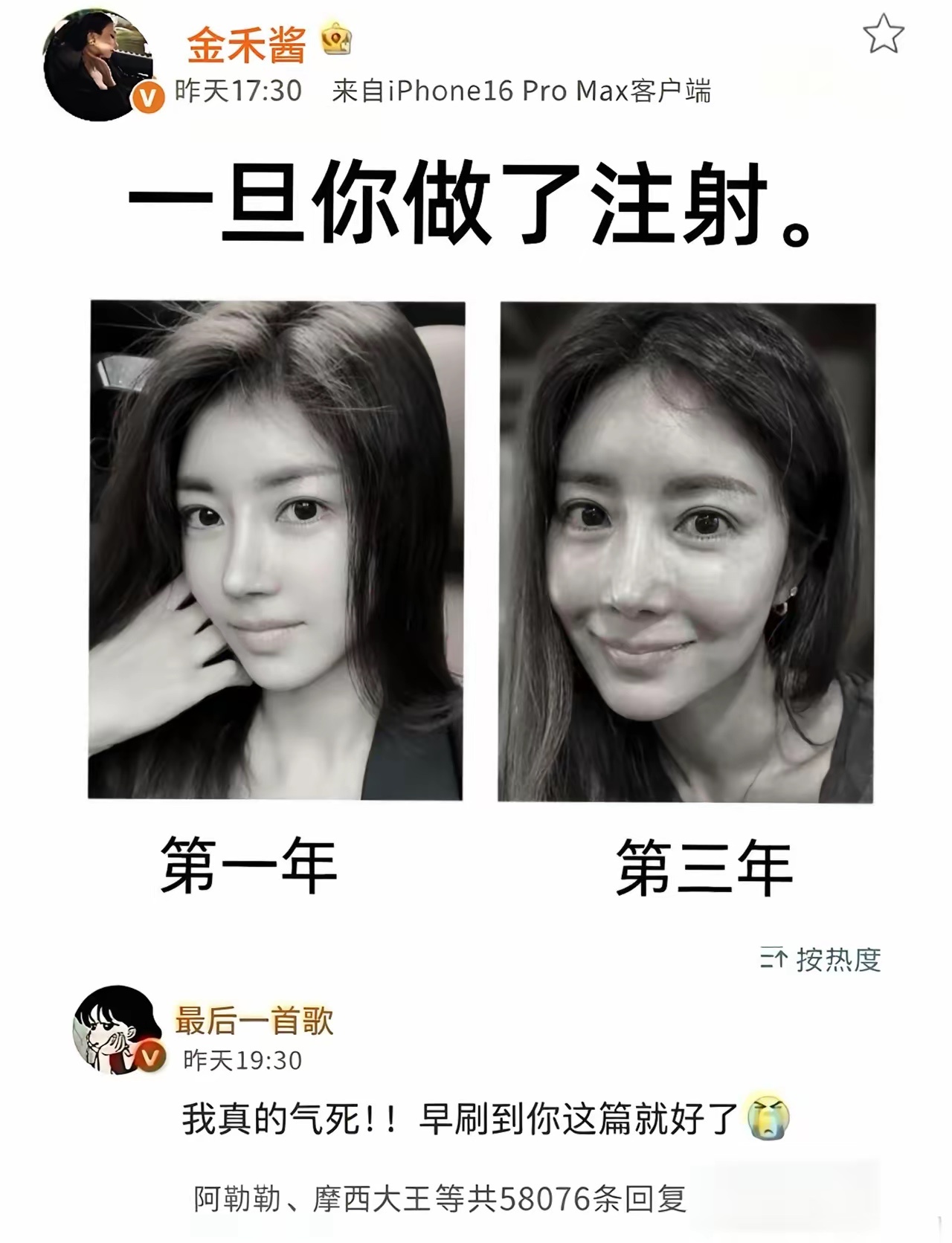 该女生用自身经历，提醒大家不要做医美，会有后遗症，结果被从业人员追着骂！ 