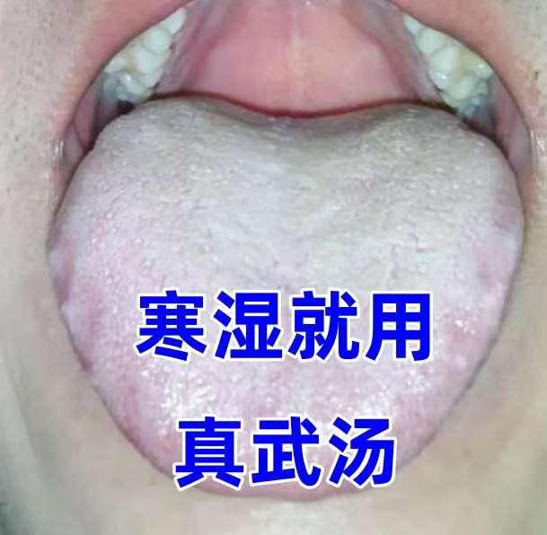 医圣张仲景亲传：三方祛湿，寒湿、痰湿、湿热一网打尽，做清爽人！

一、寒湿缠身—