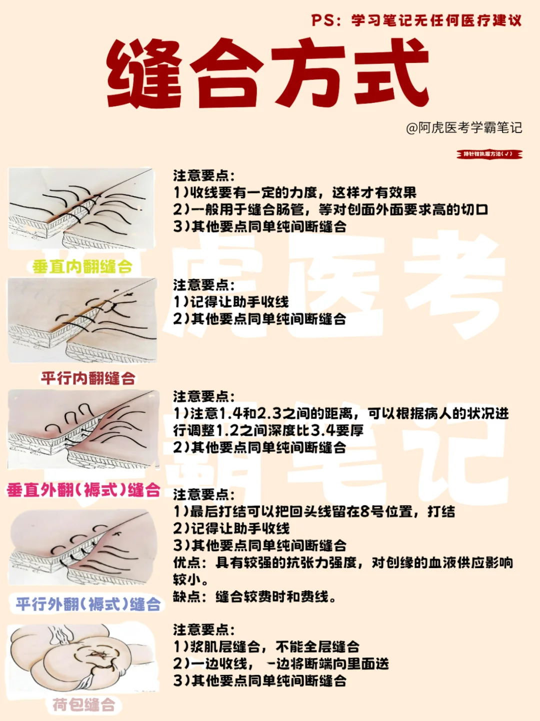 医学生笔记📒｜简单易懂的缝合方式👆
