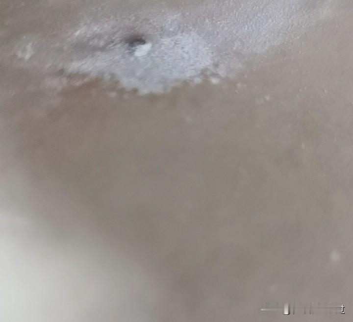 刚刚经历了一件大事。

我躺在床上，老公让我不要动，他亲自为我做了个小手术。
