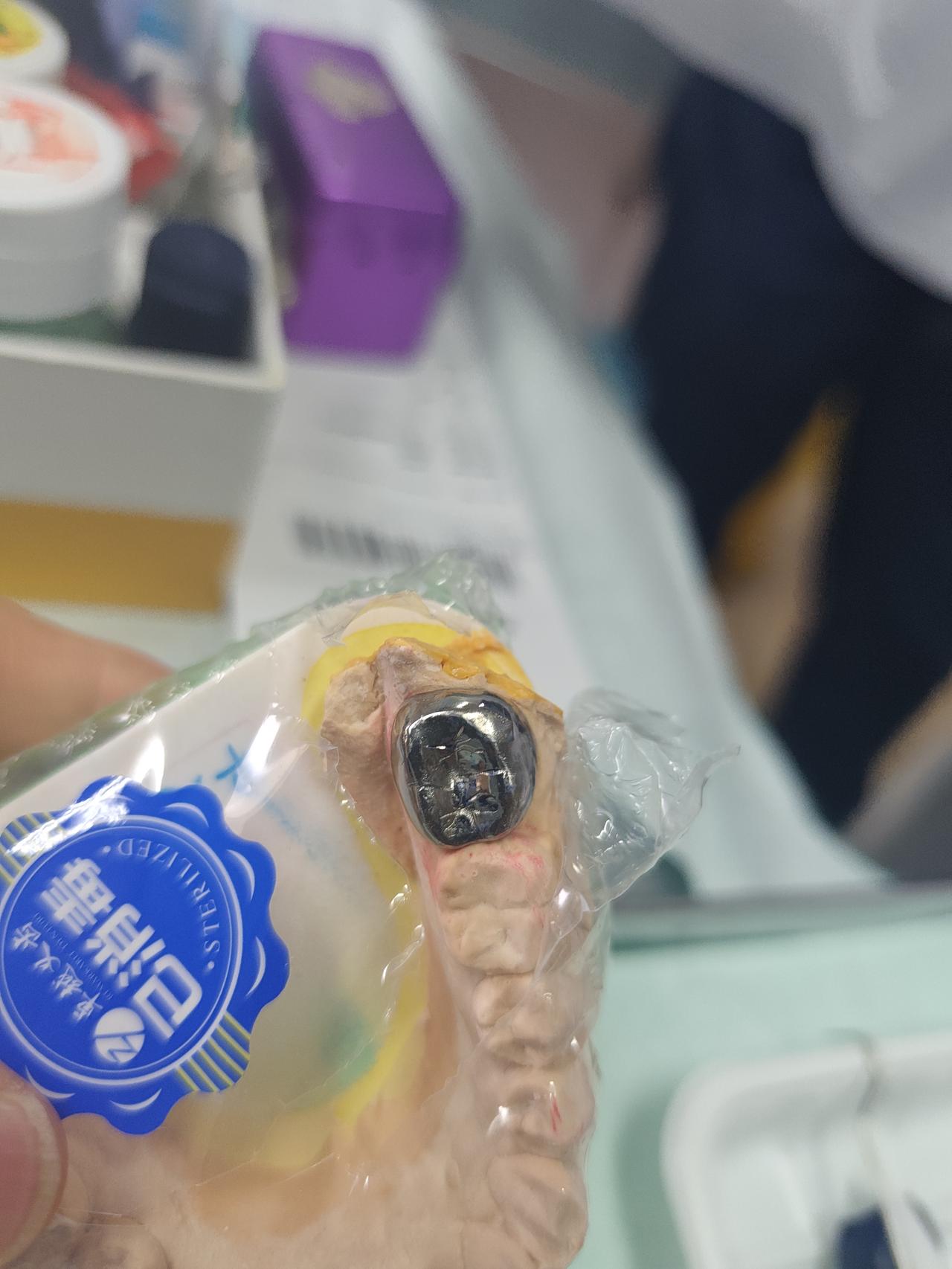 今天这个牙套做完，这一轮关于牙齿一系列的问题处理算是暂时告一段落。本来我是要求做