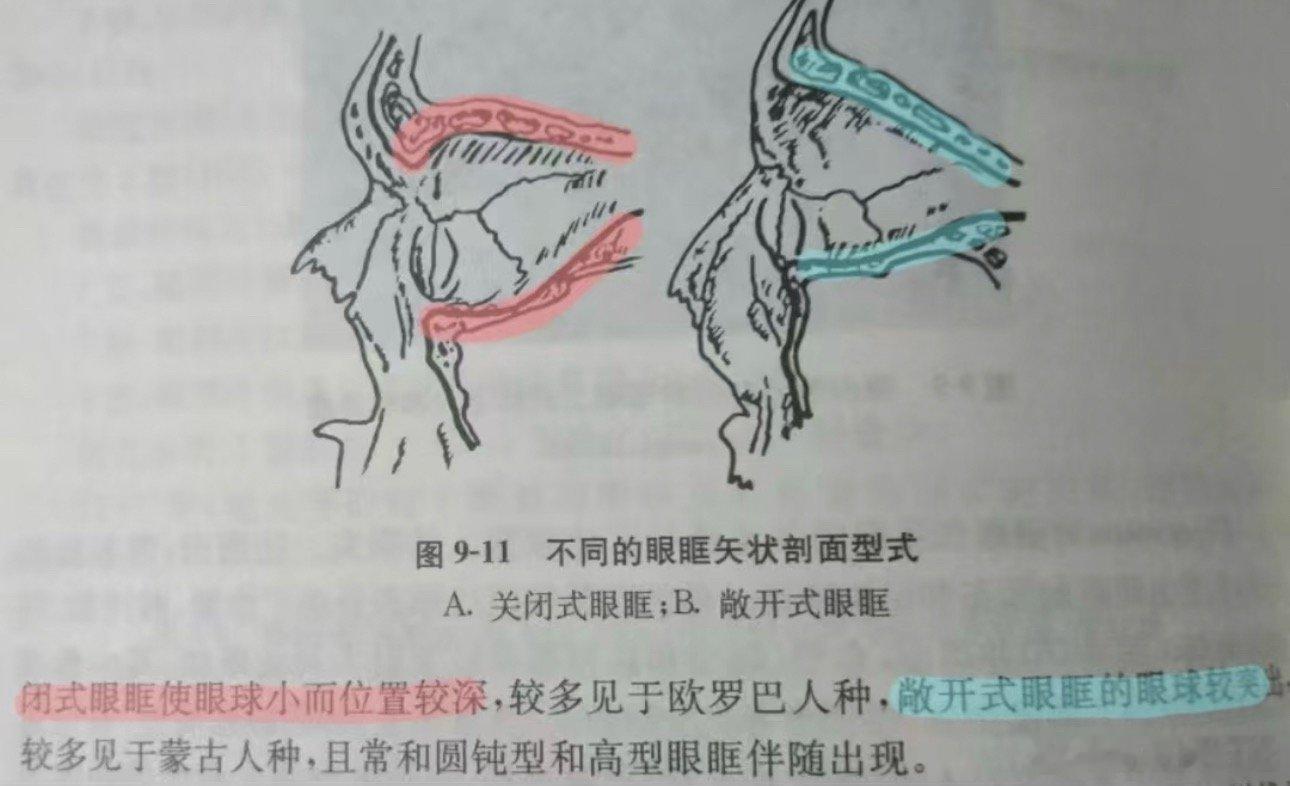 明天和大家聊聊，为什么有些人天生双眼皮比较深，看起来像割宽一样有肉条感。 