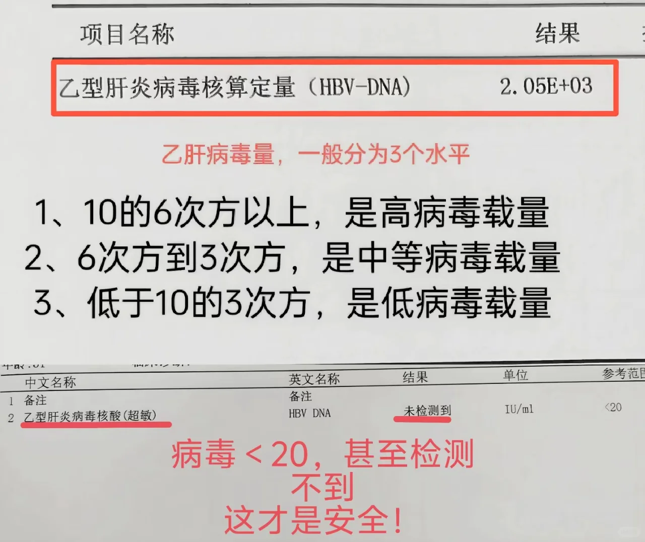 乙肝超敏病毒定量更为准确！