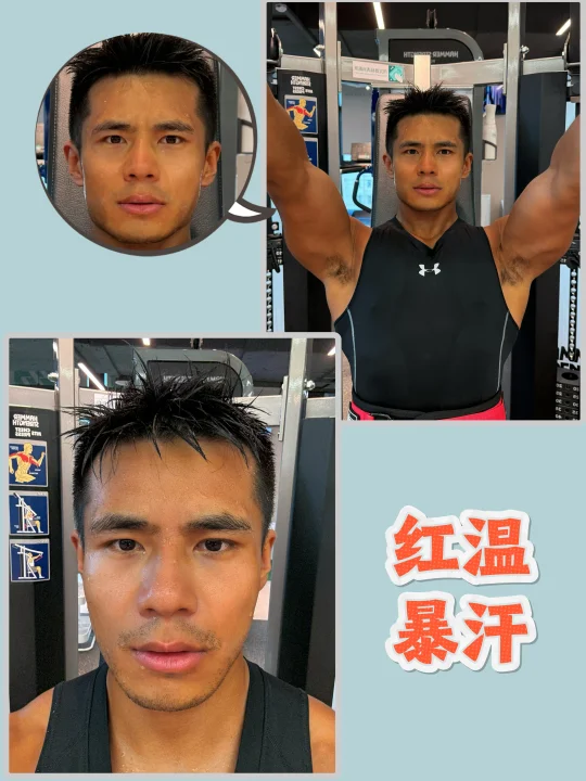 拒绝法令纹危机|