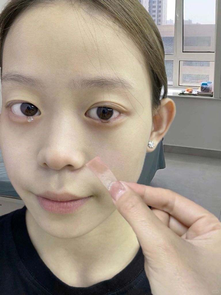 去切痣被骂了..早看不受罪！帮助一个是一个