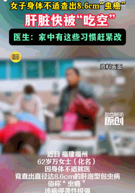 病从口入！福州，一62岁女子因身体不适，竟查出肝内藏着一个直径达8.6cm的巨大