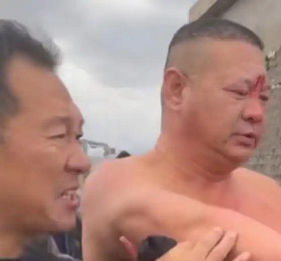 英雄啊！《【🔥百度热搜】江苏男子惊涛中救人，被离岸流卷入大海，全身划破仍带血成