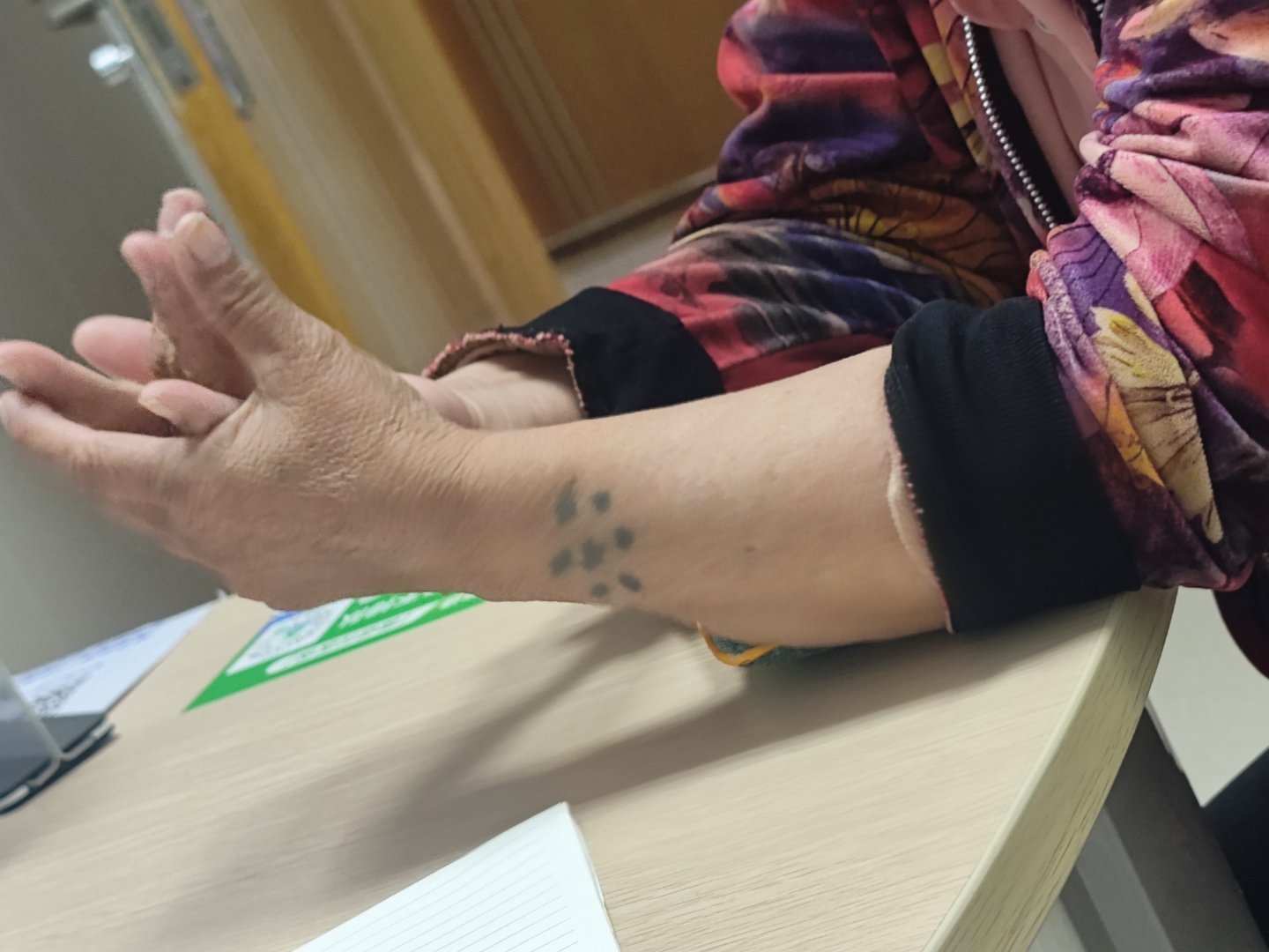 我的门诊故事  一上午差不多有4个老年女性患者，早年在左手前臂纹了7个墨水点，所