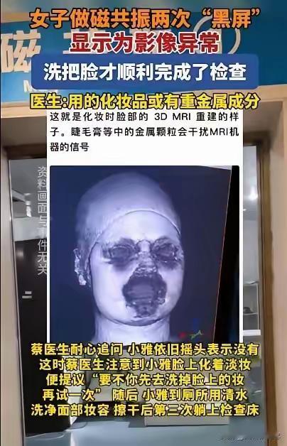 这化妆品竟让磁共振两次罢工！

   福建29岁女生头晕做检查，

   摘光金