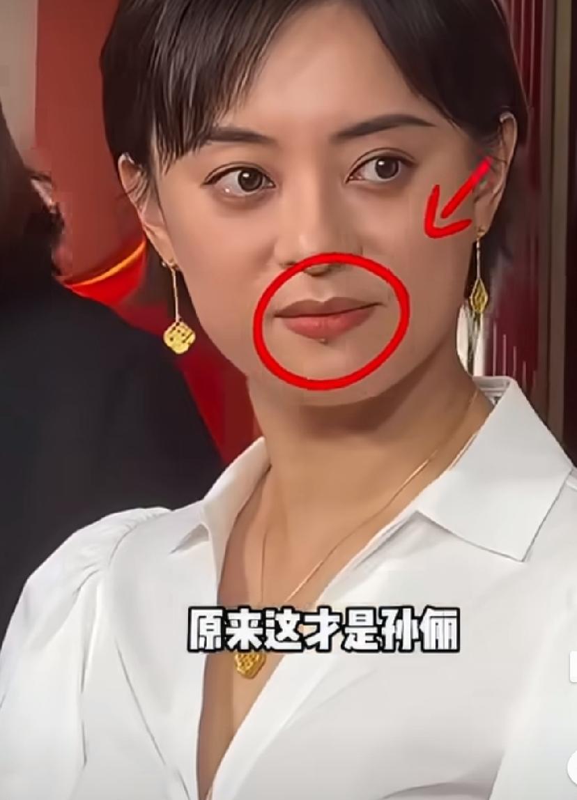 5月31日，孙俪工作室晒出孙俪的活动照，有网友发现孙俪下嘴唇下边的痣没了，那颗痣