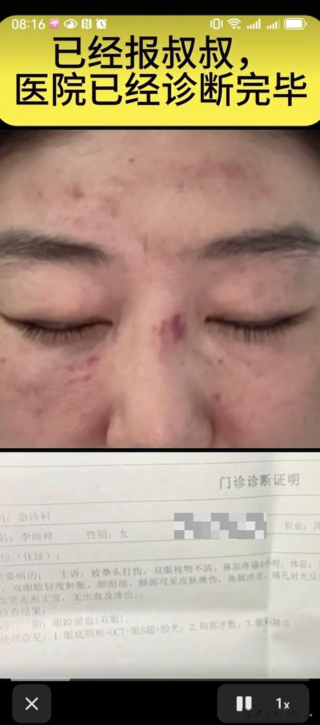 相宜又摊上事了！她亲妈第一个动手攻击禅禅，薅头发，挠脸。如果不是现场人多，就相宜