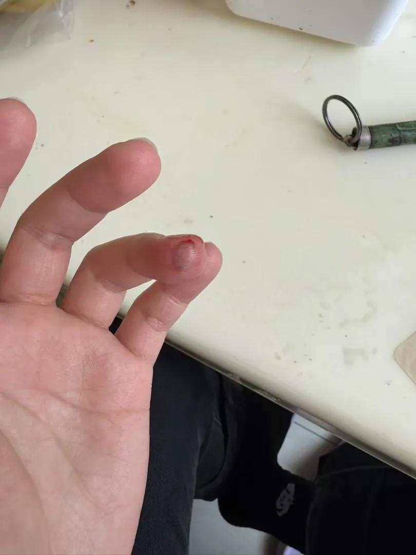 太遗憾了，
关注我的女性朋友太少了，
很多女性问题想咨询，
也咨询不了！
哎！