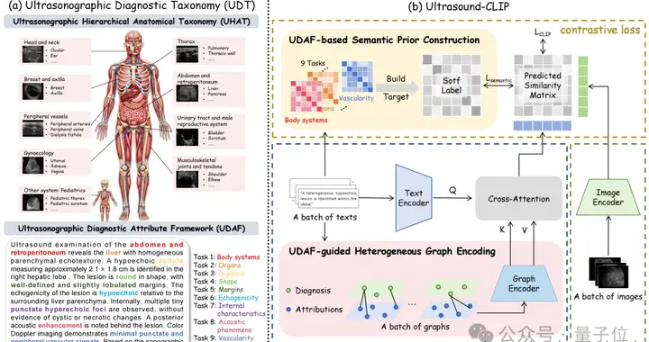 36.4万超声图文对！中国团队构建首个大规模超声专属数据集