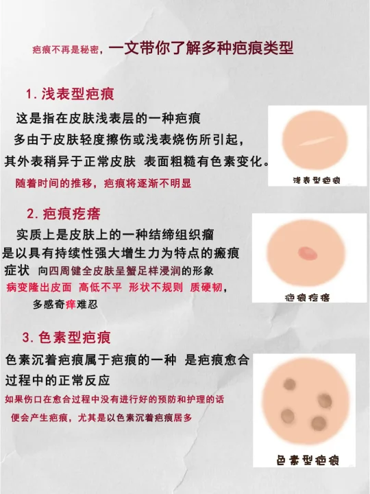 疤痕不再是秘密，一文带你了解多种疤痕类型