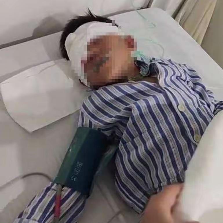 你能想象吗？浙江一个7岁男童，手持筷子准备吃饭时，突然摔倒，一截约5厘米长的断裂