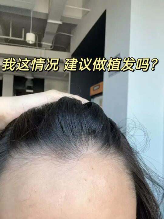 上海九院冷冰怎么样？