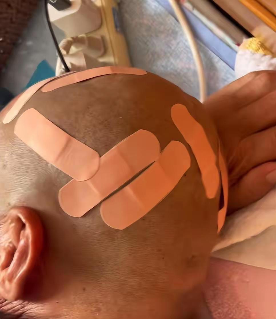 大爷花10元剃头后满头伤口不忍追责！
“别去别去，现在干啥都不容易。”

在天津