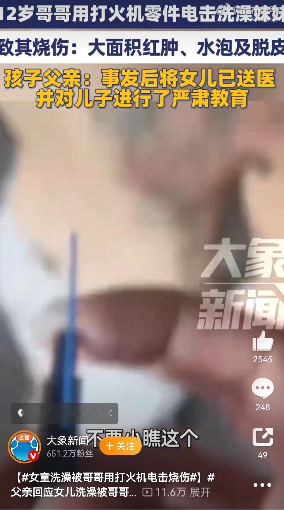 近日，一则“女儿洗澡时被哥哥用电击方式致烧伤”的消息引发关注，涉事女孩父亲于当日
