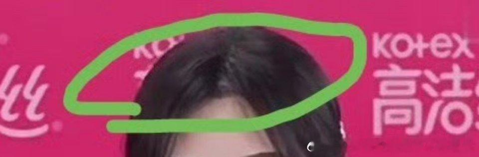 白鹿戴假发没遮全我觉得你们不要太苛刻了。比如我们家发际线这样婶儿的，都是夸夸溺爱