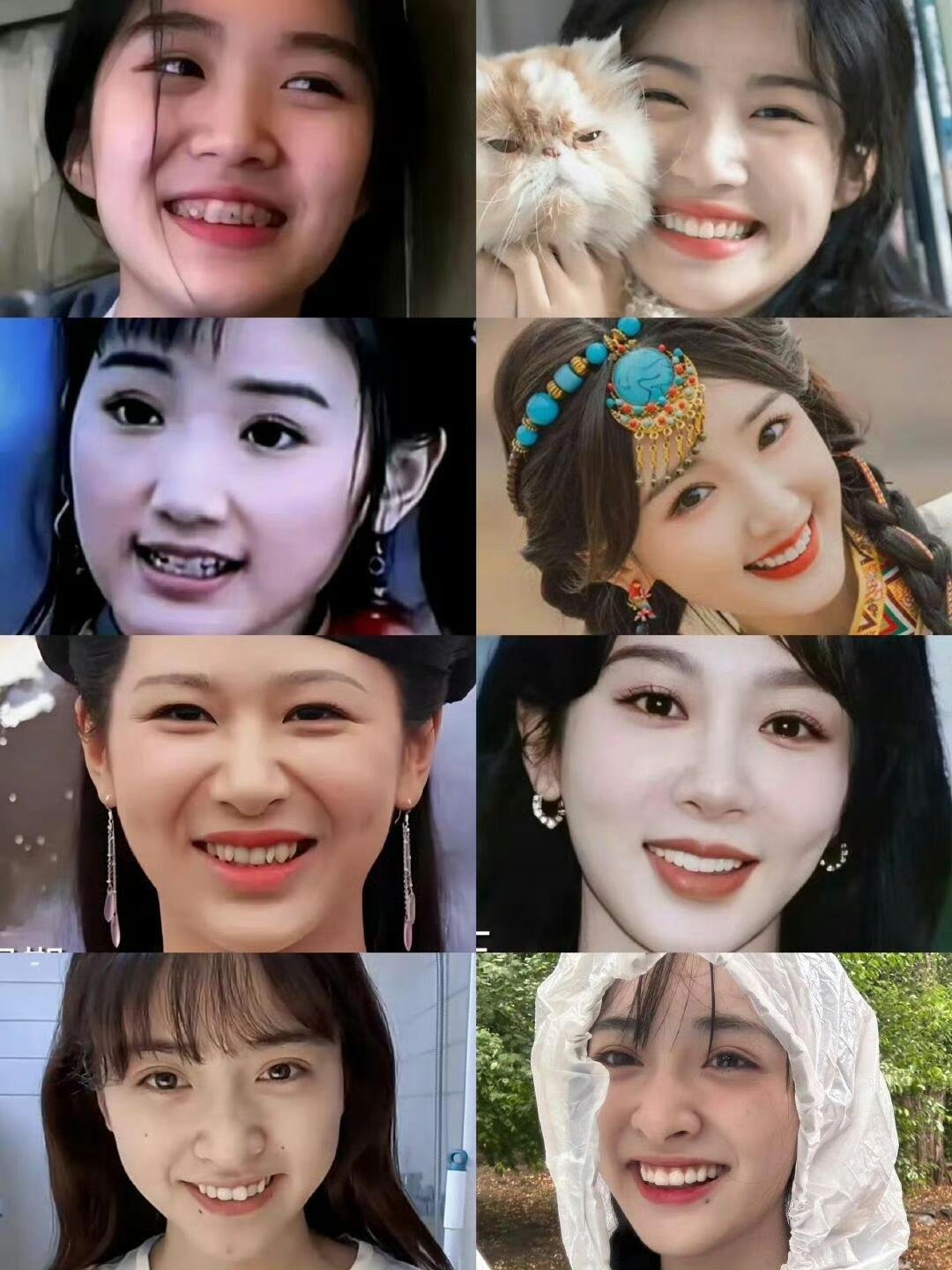 不是，明星的牙不用戴保持器的吗？ ​​​