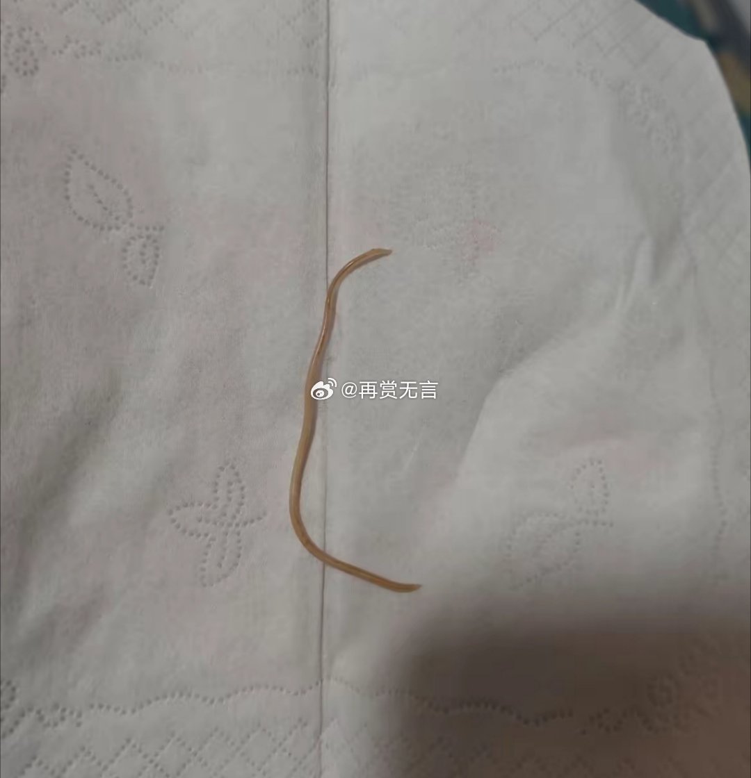 小时候每年都要吃打虫药，拉出一根根蛔虫，有的卡一半还要用手拉出来。现在的孩子怎么