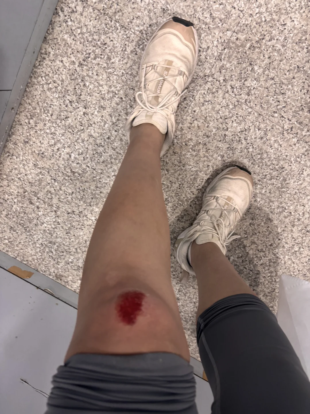 望京肇事逃逸 你逃的了一时逃不了一世