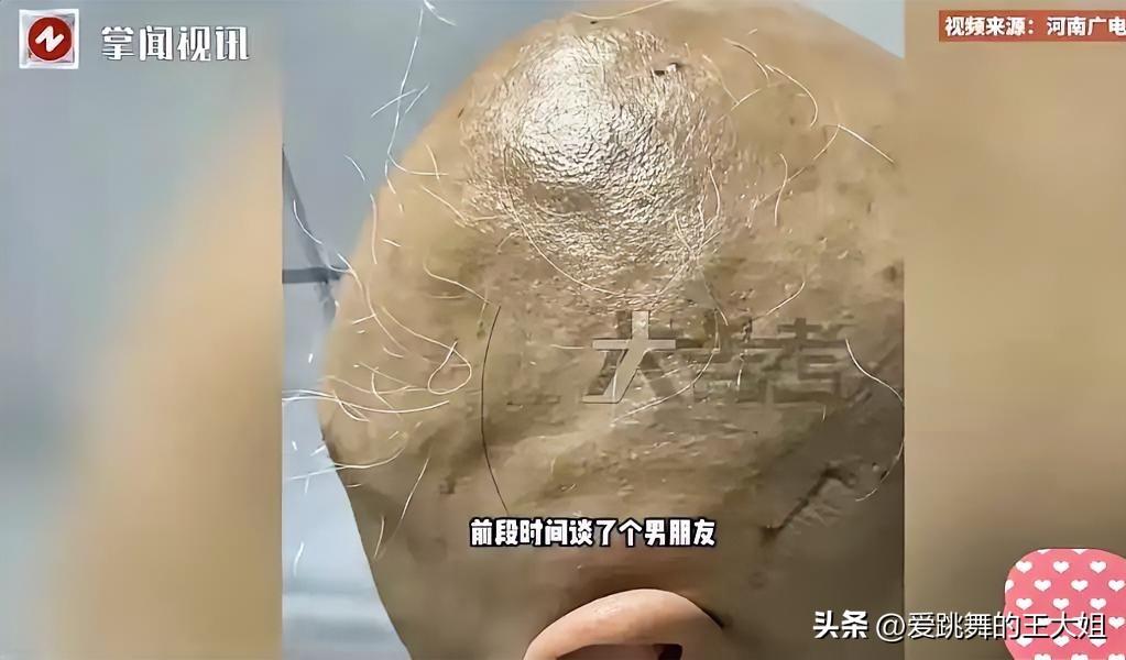 问世间情为何物。 河南郑州一个20岁女孩被男友断崖式分手后，一时无法接受，开始整