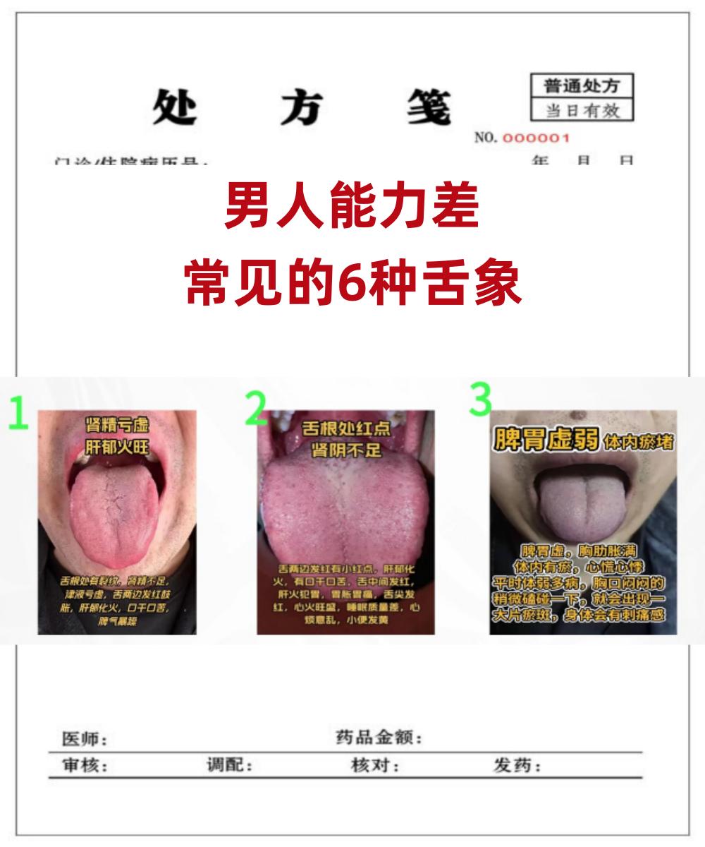 男朋友有心无力，6种常见舌象分析，中医帮你找准病根！

空余时间帮大家分析舌象，