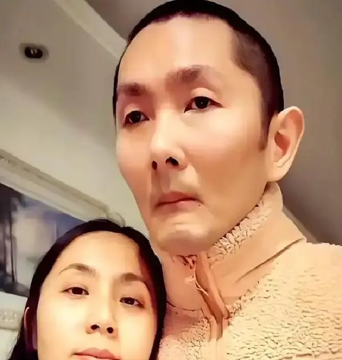 2017年夏天，安徽合肥一对刚交往没多久的恋人遭遇大变故。男友彭亚楼在家煲汤时煤