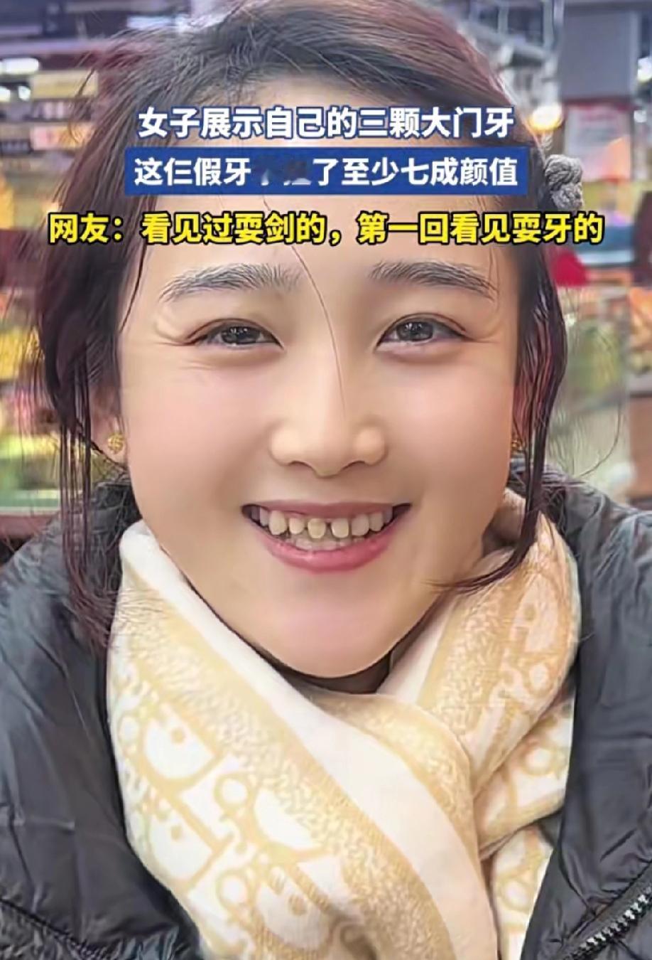 论门牙对颜值的重要性
这是小时候吃了多少糖，才整成这样？
话说这牙套会不会掉肚子