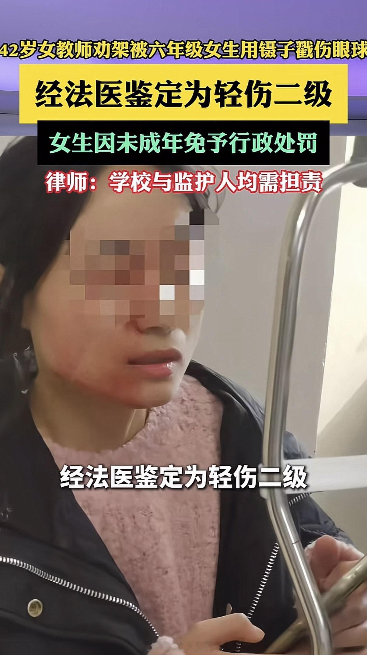 学校通报老师劝架被学生戳伤眼球那可是眼睛呀…这年头教师真不好当。角色互换，赔款白