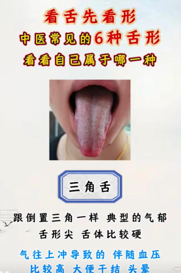 看舌先看形，6 类舌象分别代表什么