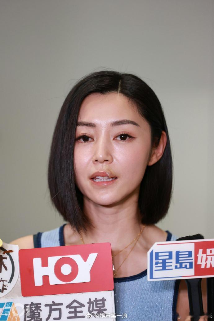 曾志伟回应卫诗雅拍戏受伤 据港媒，曾志伟回应卫诗雅拍摄《狩谎》时受伤，称：“真的