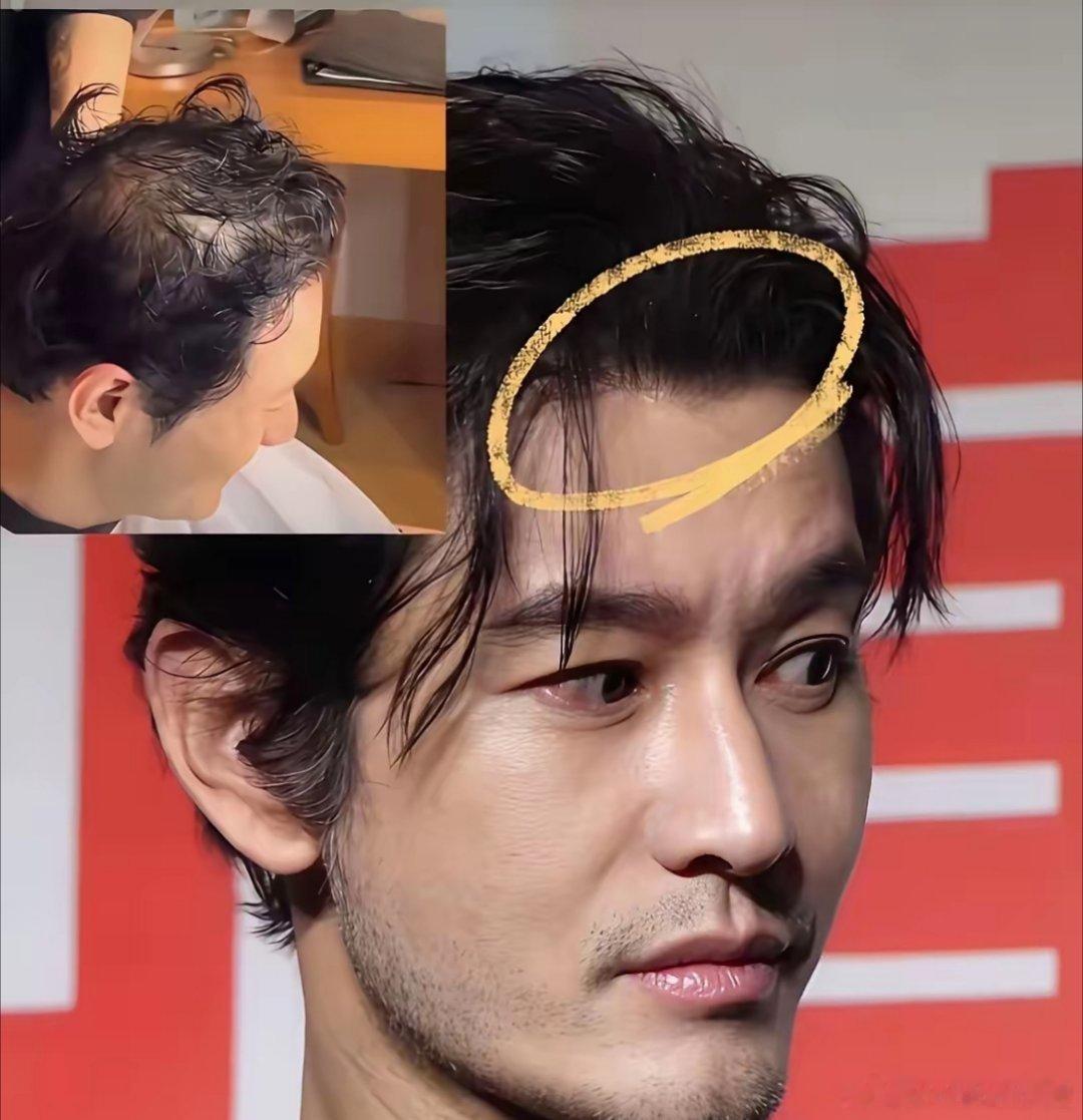 闺蜜说黄晓明年轻时候，二十几岁就有秃顶迹象，早就戴假发了。我应该相信闺蜜说的吗？