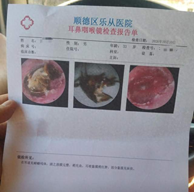 广东男子耳朵里进了蟑螂，最危险的其实是你自己那几步操作？