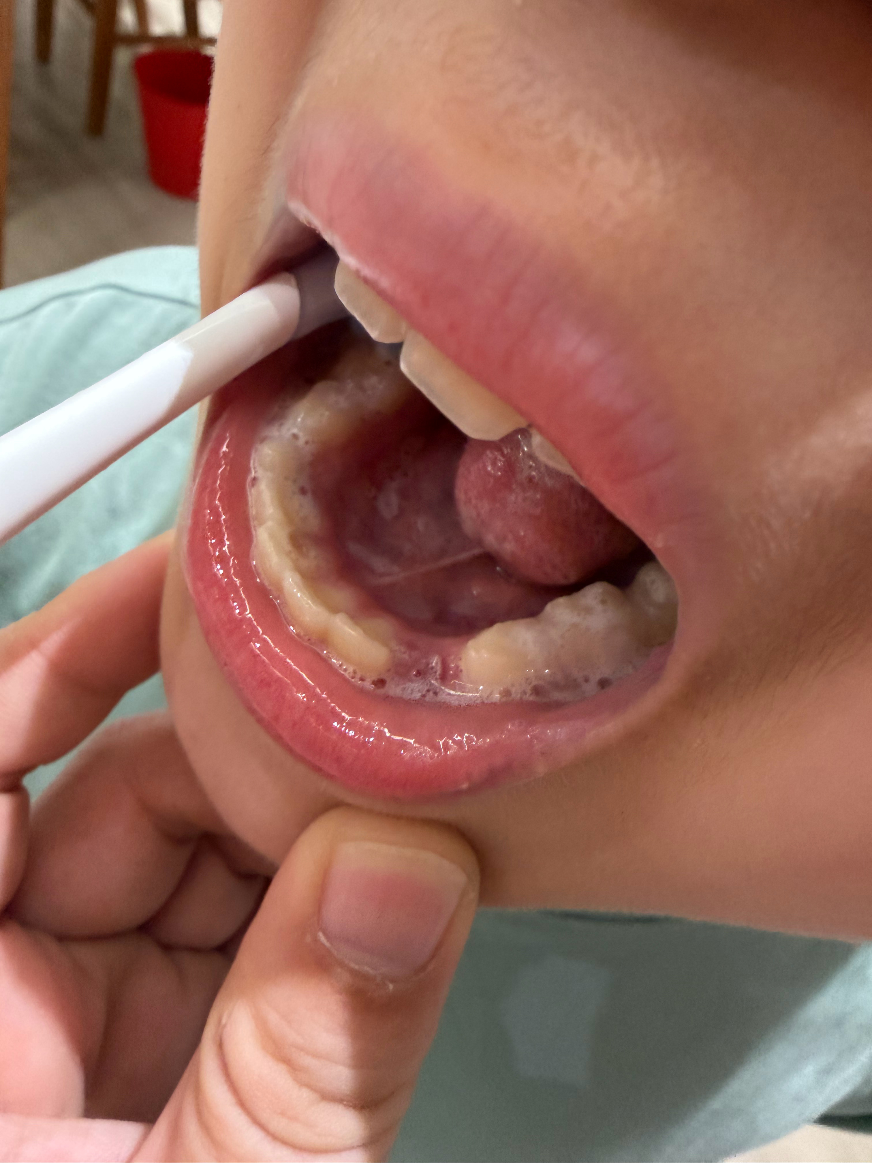 今天老大掉一颗牙，晚上刷牙的时候专门找我，说你得给我牙刷设置一下，我这个牙掉了刷