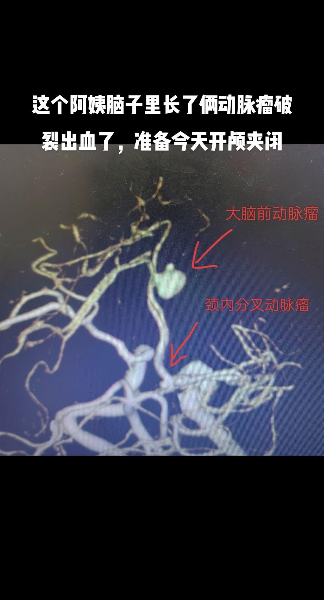 医路前行 医学影像 抖医医生