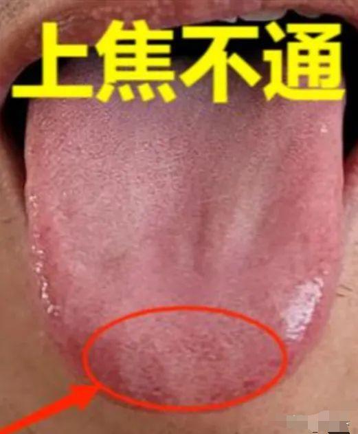 三焦不通，健康受阻！分别针对上、中、下三焦，助你恢复气血流通
1. 上焦
上焦关
