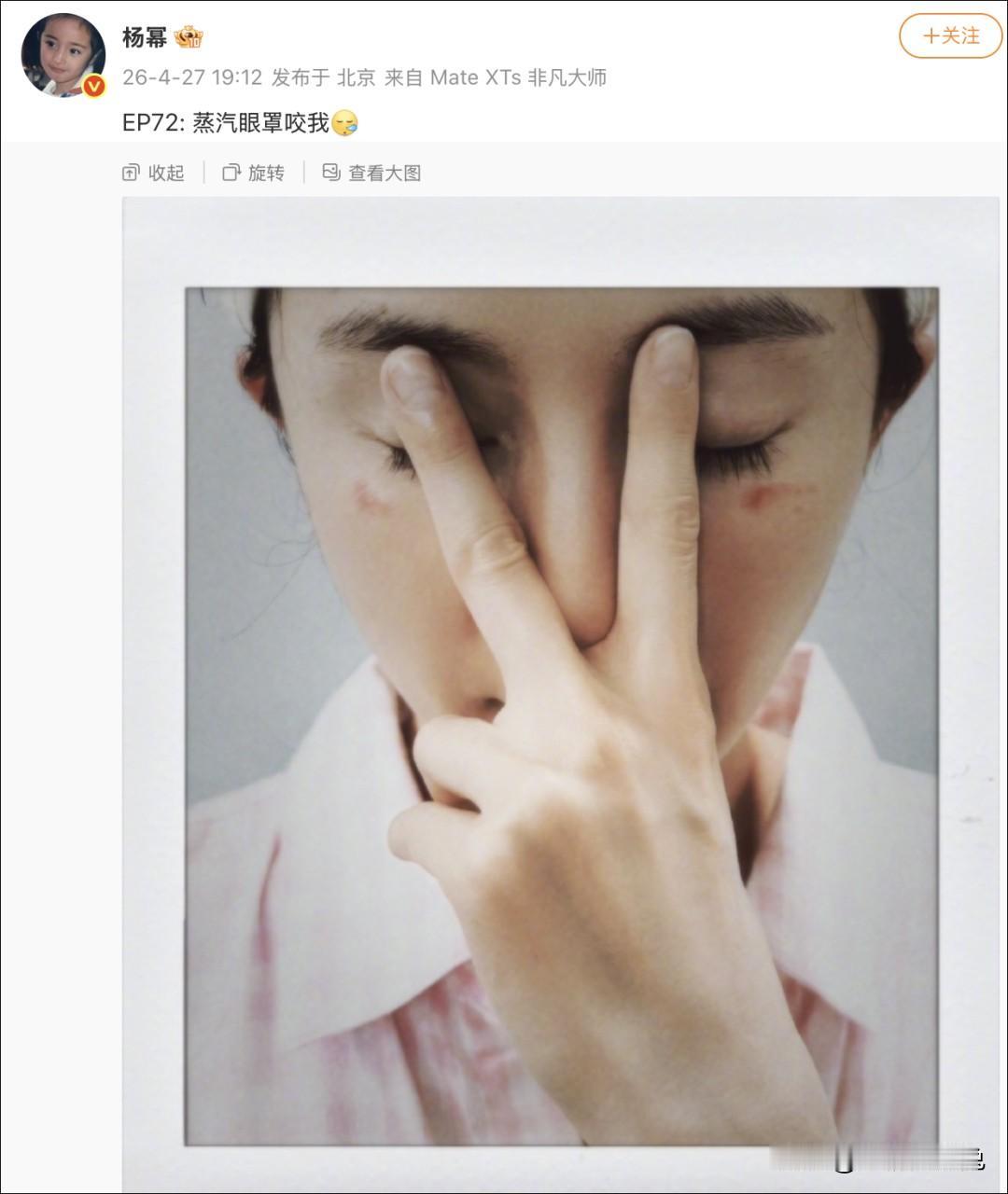 杨幂竟然被这个常用的东西咬了，以后我也再也不敢了