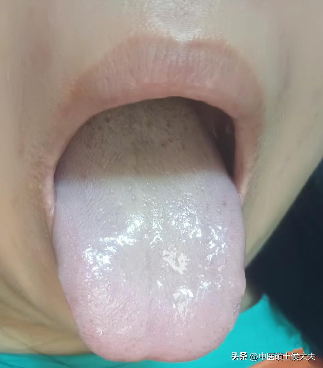 欲望低下你以为只有男人有吗？其实女人也会有[狗头]

姑娘28岁，一开始遮遮掩掩