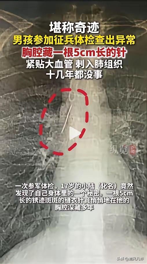 “命真大啊！”近日，一位17岁少年满心欢喜的去报名参军，可体检的时候却出了问题，