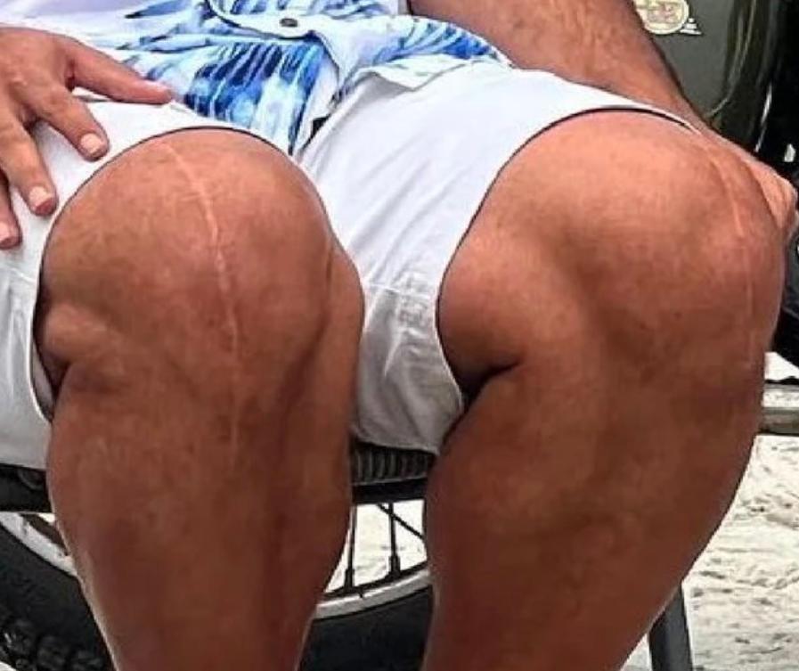 看腿猜人
当他第一次受伤的时候，大家都在祝福他快点好起来
当他第二次受伤的时候，