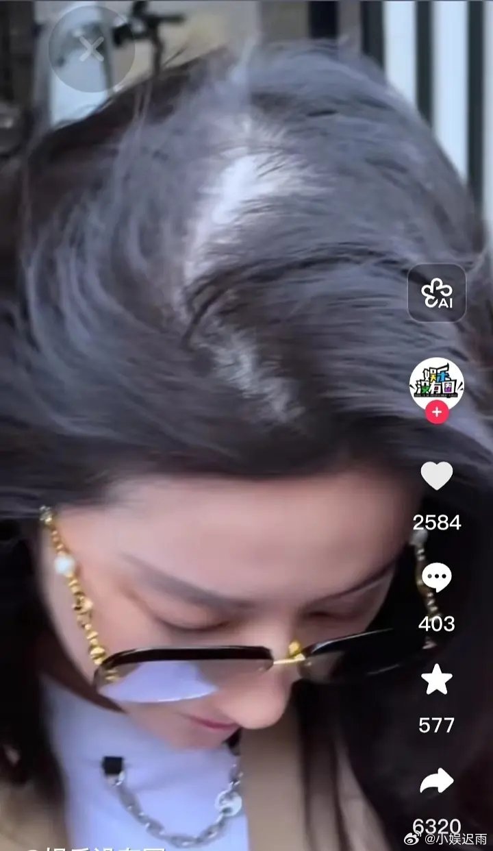 这是迪丽热巴吗 头发怎么这样了 