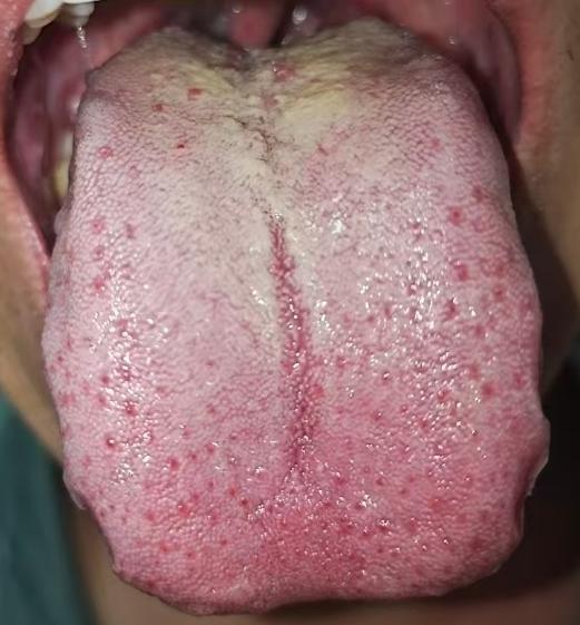 宗筋失养难恢复？多是肝虚气滞，疏肝补肝是关键







很多男同志到了中年就